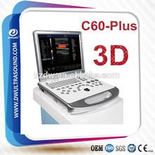 Máquina médica de la ultrasonografía cardíaca del ordenador portátil 3D y 15 &#39;&#39; máquina médica médica de la ecografía del doppler médico color del LCD 3D